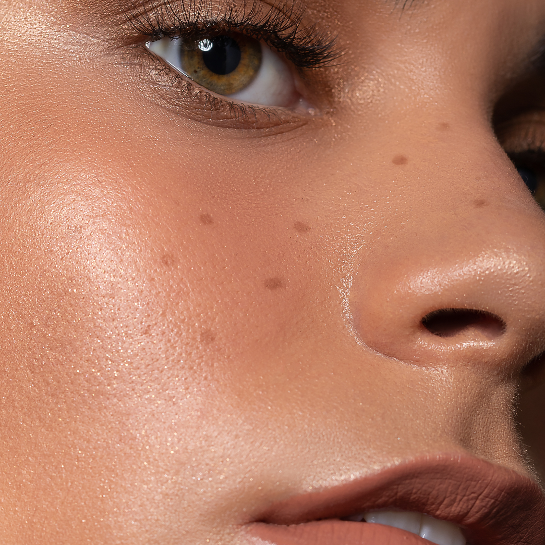 The Perfect Dermapeel